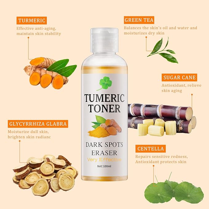 Toner for Dark Spots Turmeric Dark Spot Corrector, Facial Toner for Acne Prone Skin, Dark Spot Correcting Hydrating Face Toner for Women Moisturizing for All Skin Type- 3.4 OZ