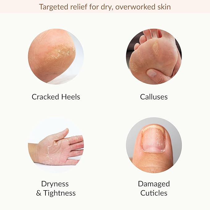 Epielle Hydrating & Moisturizing Hand & Foot Masks, Relieve and Soften Dry, Rough Skin, Self Care Gifts for Women, Spa Kit, Easter Basket Stuffers, 6 Moisturizing Gloves & 6 Moisturizing Socks