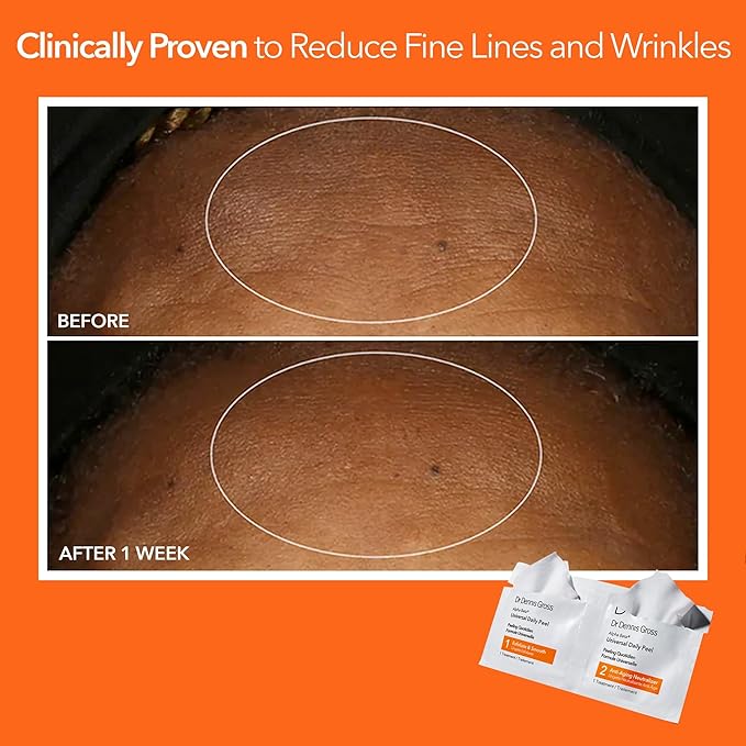Dr. Dennis Gross Alpha Beta Universal Daily Peel: for Uneven Tone or Texture and Fine Lines or Enlarged Pores, (60 Treatments)