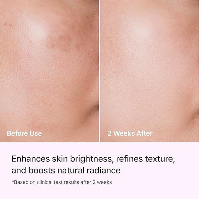 REJURAN® Triple Radiance Ampoule 30ml – DOT™ c-PDRN 0.5% Serum for Tone, Texture & Glow - Niacinamide & Licorice Extract for Even-Looking Skin