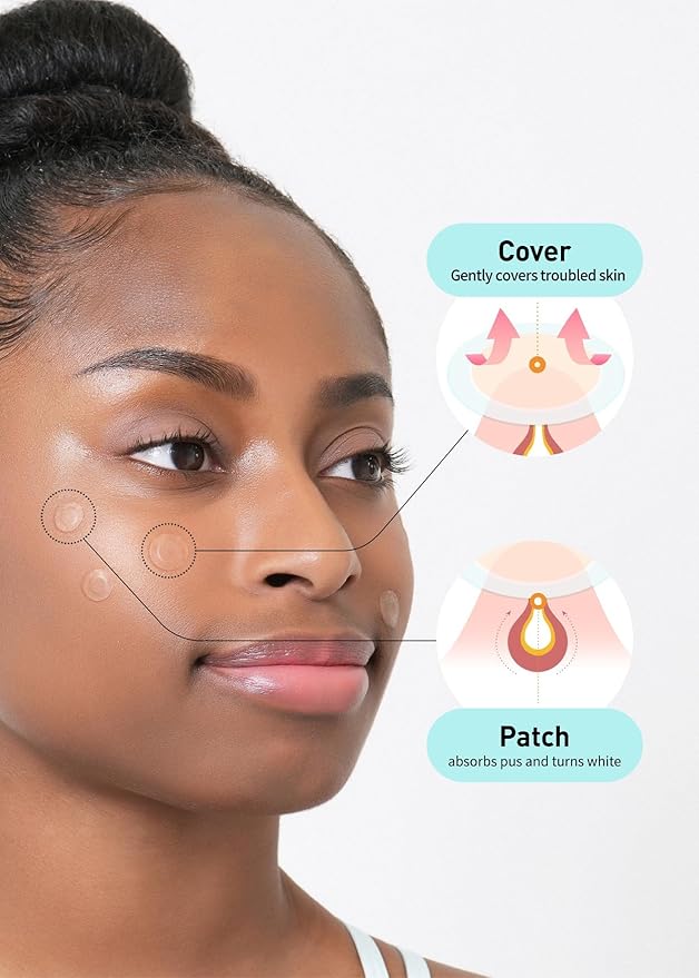 OLIVE YOUNG Care Plus Spot Patch | Hydrocolloid Acne Korean Spot Patch to Cover Zits, Pimples and Blemishes, for Troubled Skin and Face (Hydrocolloid, 102 Count (Pack of 1))