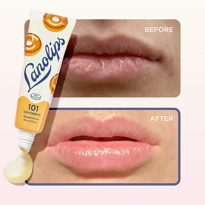 Lanolips 101 Ointment - Lanolin Lip Balm for Smooth, Hydrated & Healthy Lips - Multipurpose Lip Ointment with Lanolin Oil for Dry Lips, Cuticles & More - Glazed Donut (0.52 oz)
