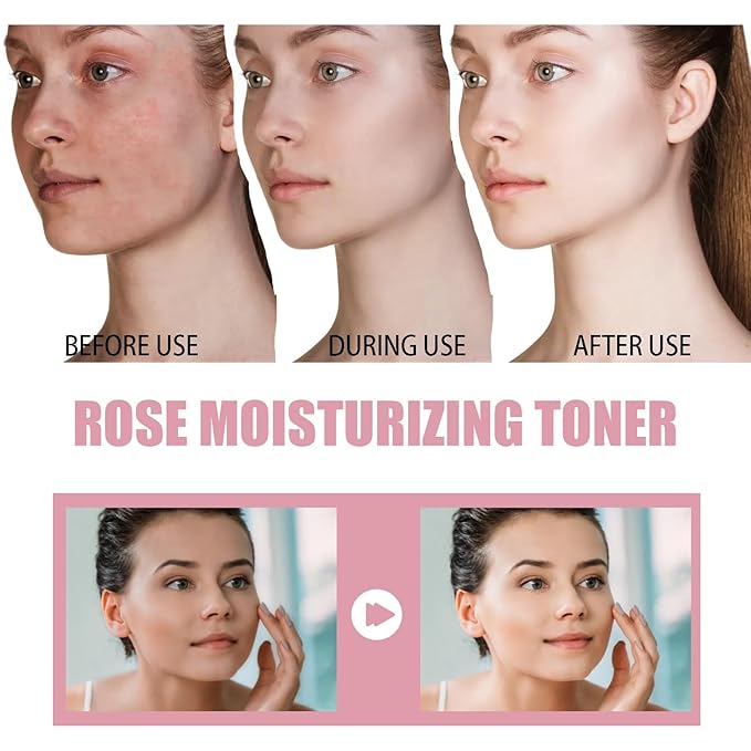 Rose Water Hydrating Spray - Deep Moisturizing Toner For Dry Rough Skin, Shrink Pores & Balance Oil(1PCS)