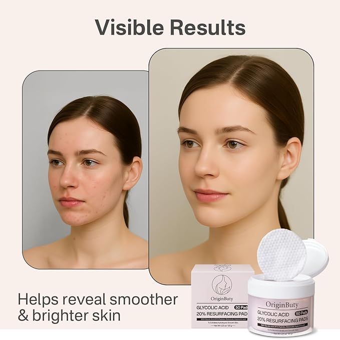 Glycolic Acid 20% Resurfacing Pads (50 Count), Exfoliating Peel Pads for Face, Skin Pore Resurfacing & Radiance, Exfoliating Toner Facial Pads with Oil, Salicylic Acid & Vitamins E, B3, B5