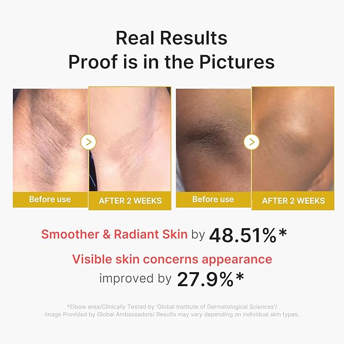medicube Dual Body Peel Shot Duo: Hypochlorous Acid and Turmeric Body Peel Shot | for Gentle Exfoliation for Dead Skin Cells, Rough Patches, and Visible Concerns | Brightening & Calming Care