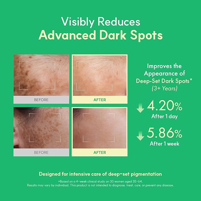 Easydew DW-EGF Melatoning Ampoule 5X - Hydrating Dark Spot Serum with Niacinamide & Glutathione for Uneven Skin - Fast Absorbing Day & Night Ampoule Korean Skin Care (Bottle 1.01 fl oz, EGF 5X)