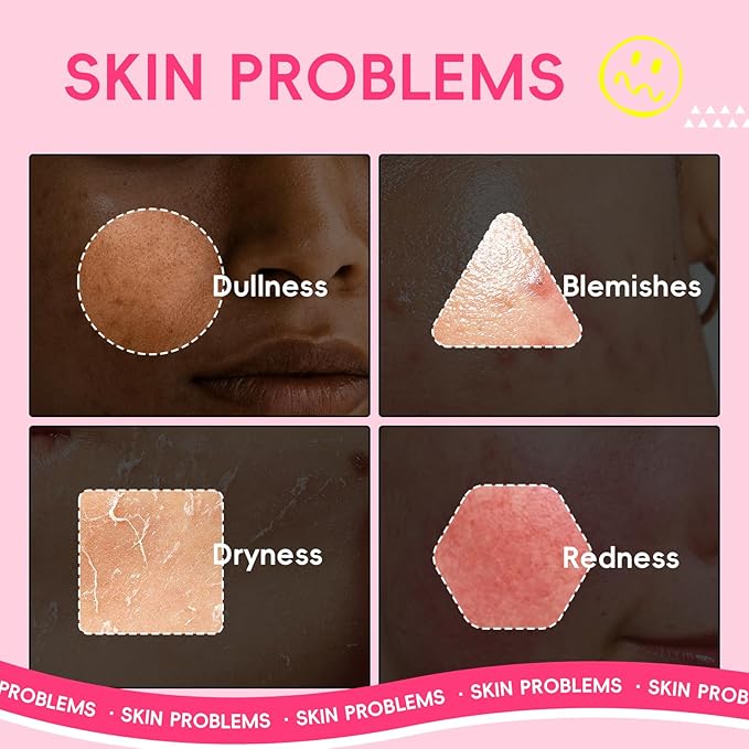 Watermelon Korean Style Skin Care Sets, Skin Care for Women Teens Girls, Beauty Skincare Gift Sets, with Facial Cleanser, Toner, Serum, Eye Cream, Moisturizer, Hydrates, Smoothes, Evens Skin tone