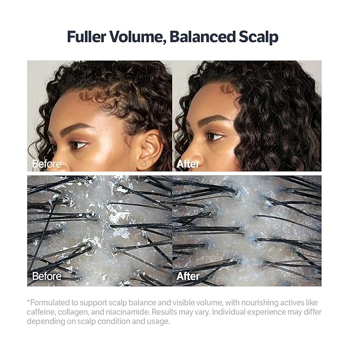 SUNGBOON EDITOR Deep Collagen Retinol Scalp Serum |Roll-On Hair Growth&Thickening Serum |Dry, Itchy Scalp Treatment |Caffeine +Biotin +Rosemary |Korean Hair Care,0.5 fl oz