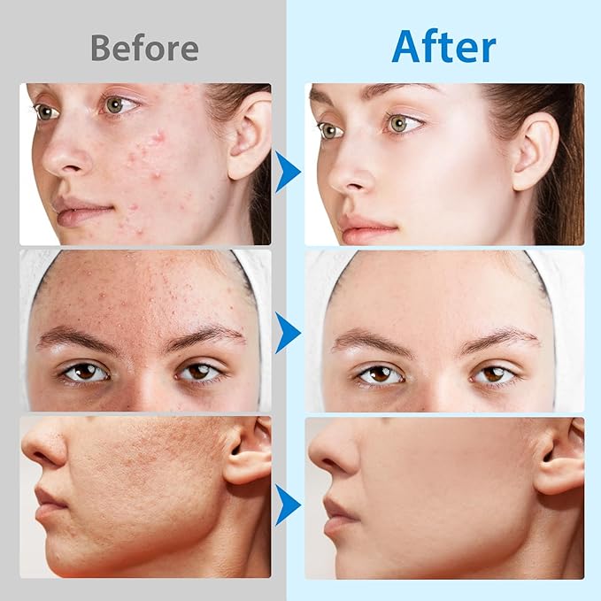 Glycolic Acid Pads for Face with Vitamins B3,B5,C & E, Green Tea, Calendula, Allantoin, Exfoliates Surface Skin and Reduces Fine Lines and Wrinkles-40pcs