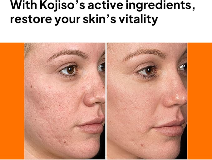 pH Lab Kojiso Set, Cleansing Bar, Toner Pad, Kojiso Skin Serum, Even Skin Tone