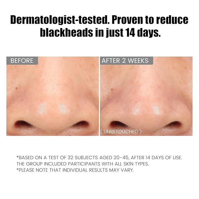 Dual-Tube Refreshing Facial Cleanser, with Double Micro-Fine White Clay Centella Asiatica Pore Cleaning Blackhead Sunscreen Remover Daily Face Amino Acid Cleanser For Oily Skin 1PC