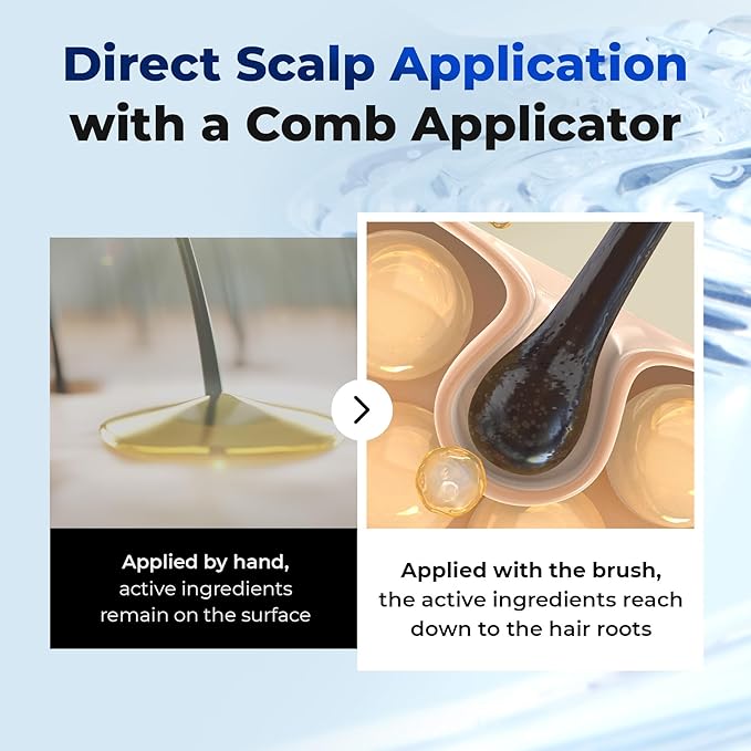 EPAIS Scalp Boosting Serum 150ml, Comb Applicator Scalp Ampoule with 38 Brush Tips, Clinically Tested Dandruff & Flake Reduction, Biome PDRN Exosome, Korean Hair Care (5.07 fl.oz)