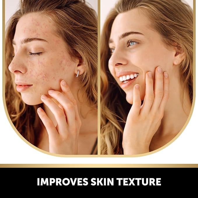 VALITIC Kojic Acid Soap for Hyperpigmentation - with Glutathione, Collagen & Vitamin C - Advanced Soap Bars with Turmeric - Original Japanese Complex for Dark Spot Correction - 2 Pack + Holder