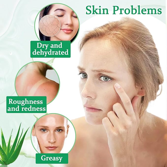 8PCS Aloe Vera Gel for Face & Skin,Organic Aloe Vera Gel,Hydrating After Sun Cream for Travel Size,Moisturizing Lotion for Skincare,After Sun Lotion for All Skin Type(F)