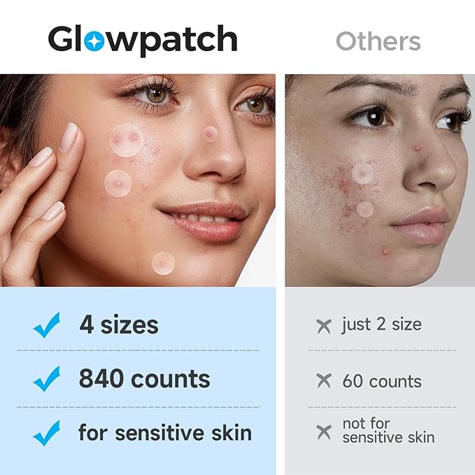 Acne Pimple Patch(840 Counts 4 Sizes), Zit Stickers for Face, Hydrocolloid Spot Stickers, Clear Acne Dots for Covering Zits, Blemishes, and Breakouts