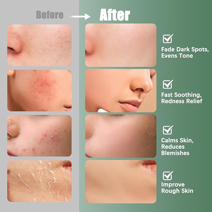 Madecassoside & Caffeine Toner Pads|Soothe Redness,Strengthen Barrier & Refine Pores with Centella Asiatica,Niacinamide | 110 Pads for All Skin Types