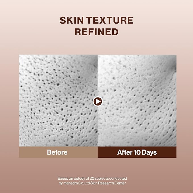 BEIGIC Treatment Essence - Hydrating Face Essence for Radiance & Smooth Skin Texture with Vegan Peptides & Niacinamide for Glass Skin (1.01 Fl. Oz)