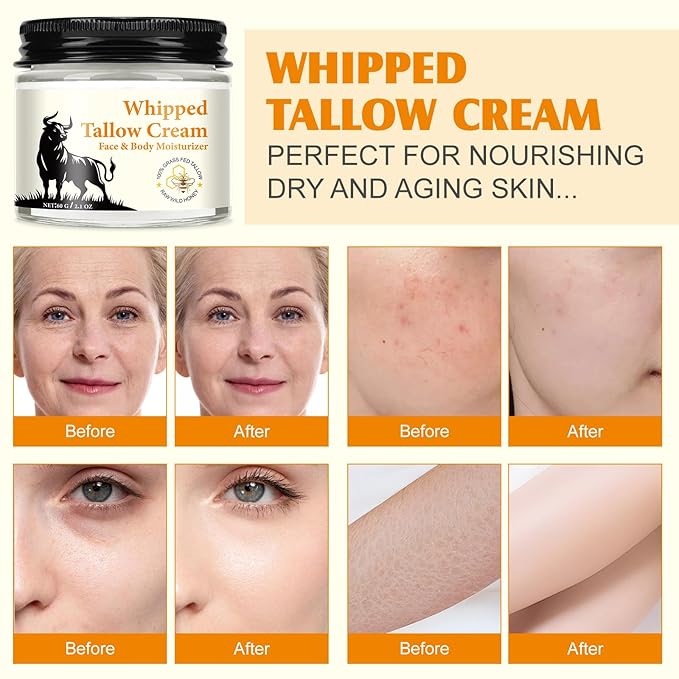 Beef Tallow for Skin, Beef Tallow and Honey Balm for Skin & Face Deeply Nourishing Face Body Moisturizer, for Dry Care & Anti-Aging- 60g