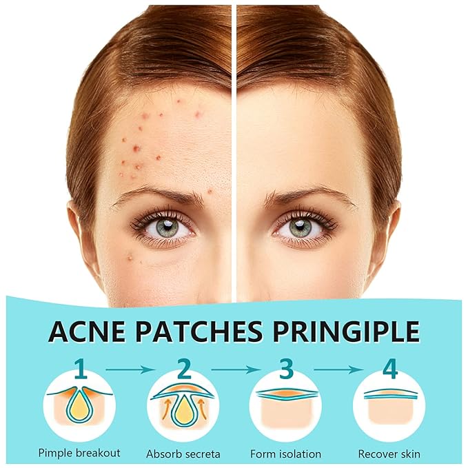 PICcircuit 180 Counts Pimple Patches for Face Hydrocolloid Acne Patches for face Invisible Zit Patches for Face Pimple Patch Acne Spot Treatment Patch Blemish Patches Cover Patches Stickers