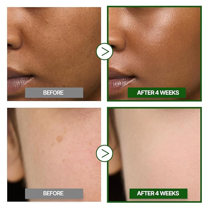 GOODAL Green Tangerine Vitamin C Cream [Advanced Ver.] – Vitamin C Cream with 5% Niacinamide | Fades Dark Spots, Boosts Radiance & Hydrates | Korean Skincare 1.69oz / 50ml