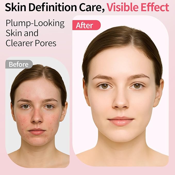 Booster Pro Pink, 4-in-1 Beauty Massager Korean Skin Care,Portable Enhanced Absorption, Radiance, Elasticity, Pore Care | LED Anti-Wrinkle Device,Facial Skin Care
