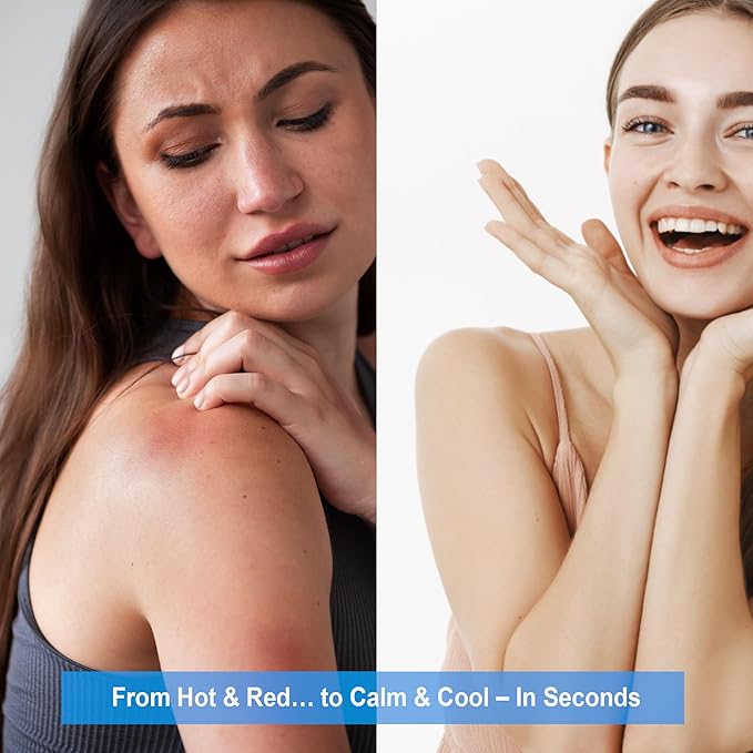 PantheDerm After-Sun Recovery Spray – Dermatologist-Developed, 7% Panthenol + Chamomile & Allantoin – Non-Greasy, Fast-Absorbing Hydration for Sunburned & Sensitive Skin, Post-Laser, Tattoo 6.76Fl.Oz