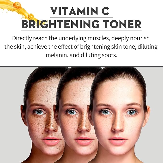 Hydrating Facial Toner - Fades Acne Marks/Spots, Boosts Collagen, Tightens Pores, Brightens & Moisturizes Skin(3PCS)