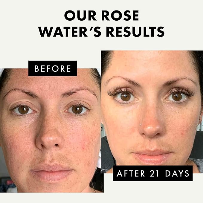 Eclat Skincare Unclog & Hydrate - Rose Water Toner and Hyaluronic Acid Serum - Combo Pack - 100% Vegan & Dermatologist Developed