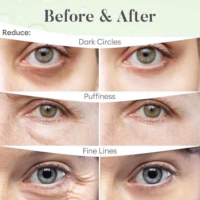 Green Tea Under Eye Patches (30 Pairs) - For Dark Circles & Puffiness - Hydrating Green Tea Eye Mask