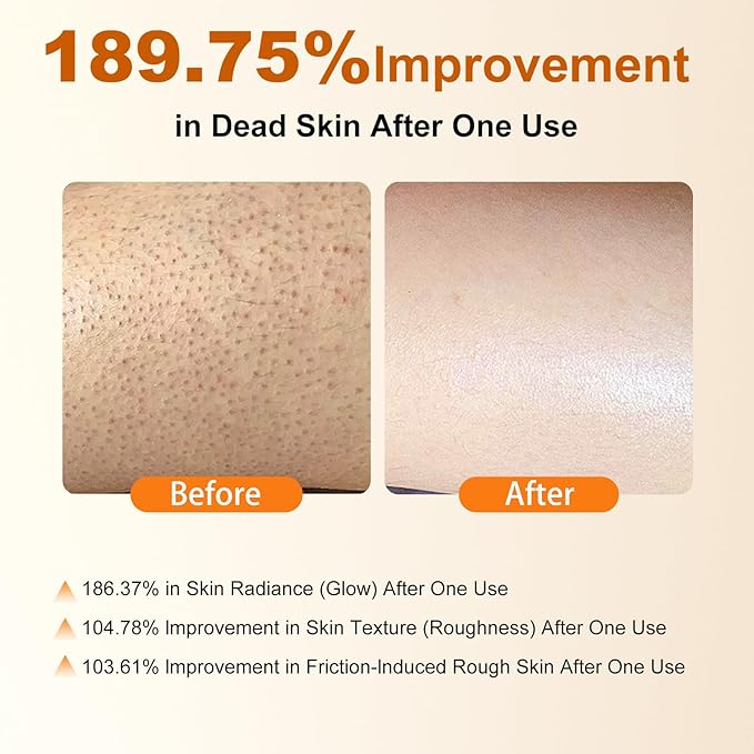 Body Keratin Care Kojic Acid Turmeric Spray: Gently Exfoliating Peeling Shot– Hydrates,Nourish your skin,Suitable for All Skin Types, 200ml - NN