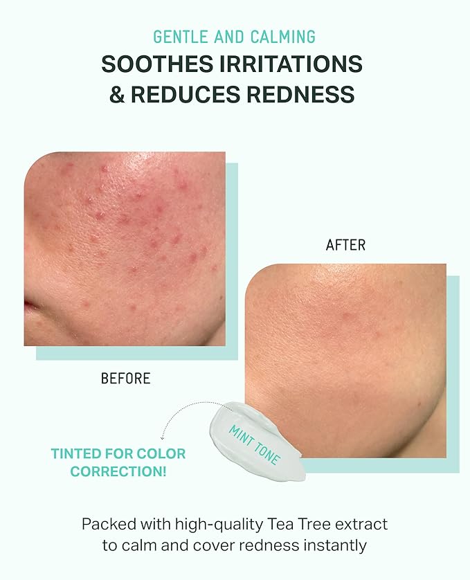 BRING GREEN Tea Tree CICA Mineral Sunscreen SPF 50+ PA++++ | Non-Nano Zinc Oxide Face Sun Lotion, Reef Safe Korean Sunscreen for Sensitive Skin, Oil-Free, 1.69 fl. oz