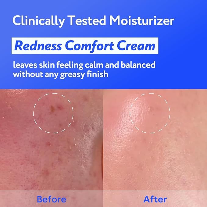 Gentle Exfoliating & Barrier Duo - Hydro Barrier Cream + Toner Pad