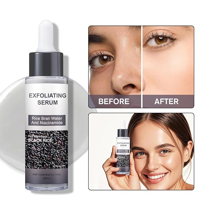 Peel Shot Glow Rice Ampoule Duo – Peel Shot Serums with White & Black Rice Extract, BHA, Niacinamide & Hyaluronic Acid – Exfoliating, Moisturizing, Blackhead Remover & Pore Refining