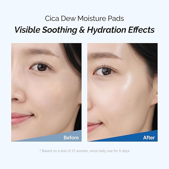 CICA Dew Moisture Pads | Cooling CICA Toner Pad for Sensitive Skin | Hydrating Soothing with Centella Asiatica Niacinamide & Hyaluronic Acid | Korean Skincare | 70 Pads (6.08 fl oz / 180 mL)