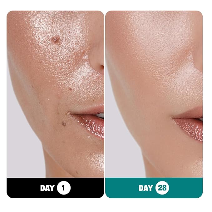 ZealSea 2% Salicylic Acid Toner for Face with 2% Niacinamide and ZealSea 2% Pure Hyaluronic Acid Serum for Face with Vitamin B5 Bundle