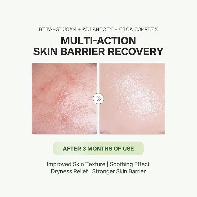 Beta Calming-Cure Essential Toner –70% Hinoki Cypress Water, Hydrating & Soothing Toner for Sensitive Skin, Lightweight Watery Texture, Clean Ingredients, Korean Skin Care, 200ml/6.76fl.oz.