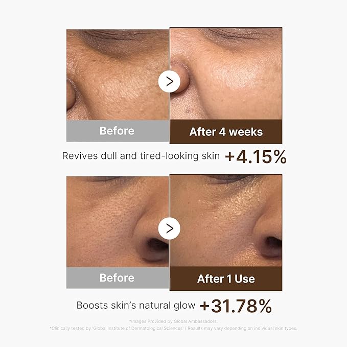 medicube Deep Vita C Radiance Pad & Serum Duo: Deep Vita C Toner Pad and Vita C Serum | Daily Tone prep for a Smooth, Radiant Texture