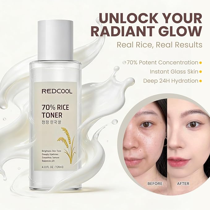 Rice Toner & Serum for Face, 70% Rice Water Facial Toner, Lightweight Hydrating Skin Care for Daily Use, Moisturizing Face Toner Suitable for All Skin Types, 120ml / 4.0 fl oz