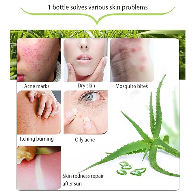 300x2 ML Natural Aloe Vera Gel -Organic Moisturizing Aloe Vera, Soothing and Hydrating, Sunburn and Scar Repair, After Sun Care for Face Body Hair