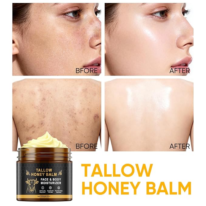 Beef Tallow Balm Skincare for Women,Moisturizer Tallow and Honey Cream for Face & Body,Deeply Hydrating Beef Tallow Skin care for All the Skin Type,Black(120g/4.23 Oz)