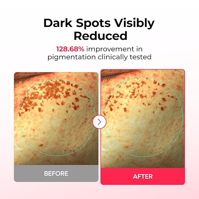 Dr.Melaxin TX Astaxanthin Melanin Recovery & Firming Hydrogel Mask (4 Sheets) – Dark Spot Correcting 2-Step Mask with Tranexamic Acid, Niacinamide, PDRN & Collagen for Elasticity