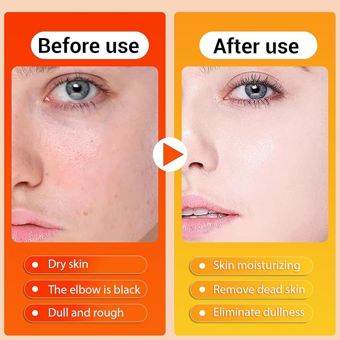 Peel Shot Keratin Care Kojic Acid Turmeric Spray, Turmeric Exfoliating Peeling Spray, Peel Shot Turmeric Spray for Face and Body, Exfoliate and Shine, Suitable for All Skin Types