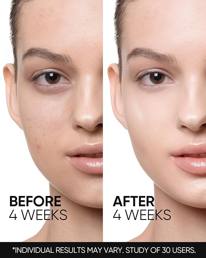 Retinol Skin Renewal Moisturizer, Retinol Cream for Face, Blemish Care, Oil Control & Pore Minimizing, Lightweight, Fragrance-Free, Night Cream for All Skin Types from Age 20+, 1fl.oz / 30g