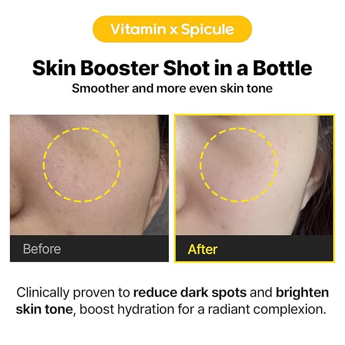 Cell Fusion C Viral Dark Spot Care Duo — Vita Shot Ampoule + Laser UV Defense Sunscreen SPF 50 Set | Dark Spot Correcting + Sun Protection | Sensitive Skin Safe, Korean Skincare Set