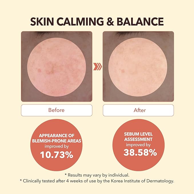 My Dermatologist's Vacation, SKIN CALMING KKUG TAMP – Double-Acting Beauty Device with Micropoint ESSENCE STICK & AMPOULE, Korean Skincare Facial Serum Kit, 8 Single-Use Sets (2 Pieces Per Use)