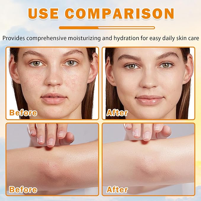 5PCS Vitamin C Skin Care Set for Teenage Girls Face Hydrating Skincare Gift Set for Women Travel Size Skin Care Kit with Cleanser, Toner, Face Serum, Eye Cream, Face Cream