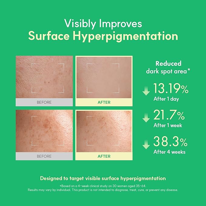 Easydew DW-EGF Melatoning Ampoule 3X - Hydrating Dark Spot Serum with Niacinamide & Glutathione for Uneven Skin - Fast Absorbing Day & Night Ampoule Korean Skin Care (Bottle 1.01 fl oz, EGF 3X)
