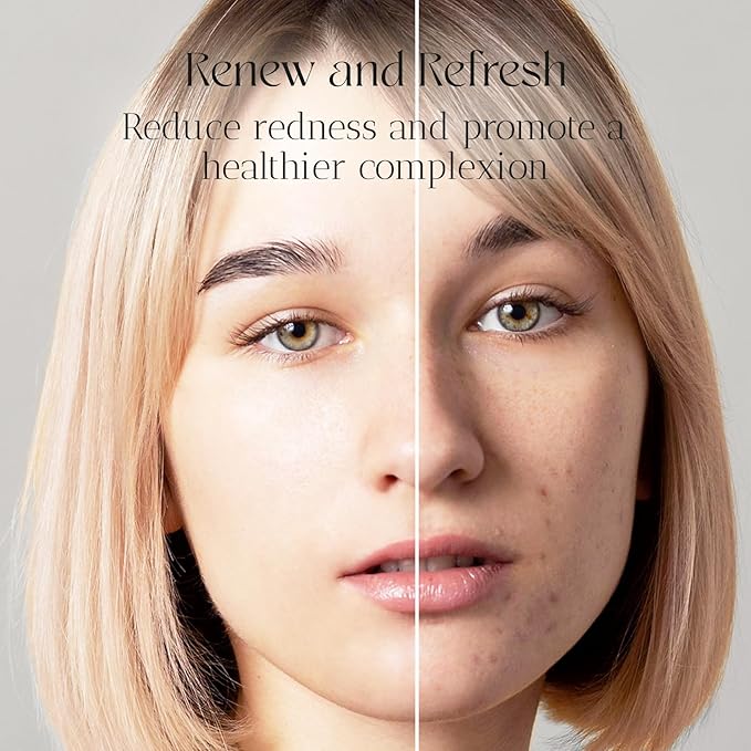 Acne Toner for Face - Infused with Tee Tree Oil, Salicylic Acid, Niacinamide, Glycol Acid - Gentle for Your Skin and Keeps You Hydrated