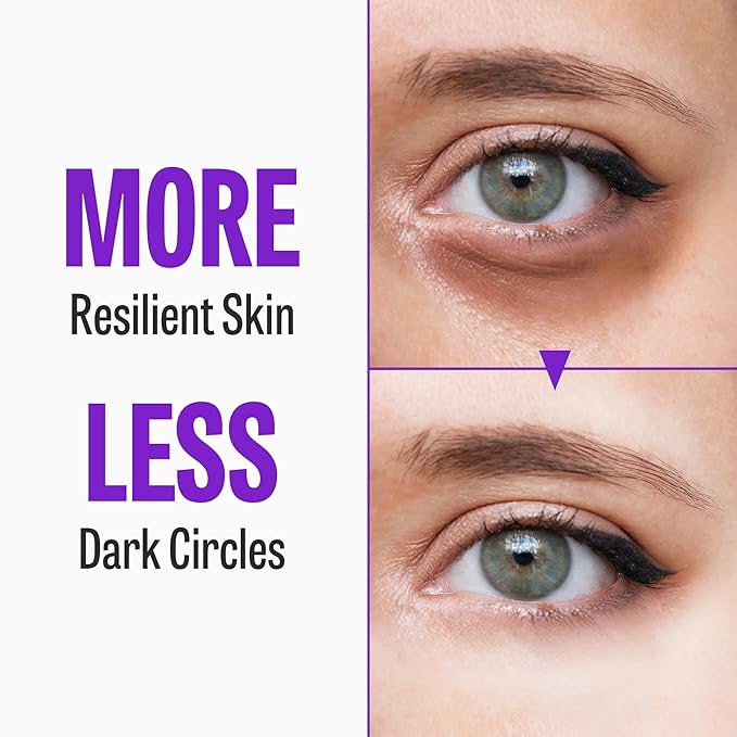 MAXCLINIC Time Return Melatonin for Dark Circles & Fine Lines | Clarifying Cream for Bags Under Eyes | Firming Eye Cream for Fine Lines| Moisturizing for Eye Care (0.70 oz)
