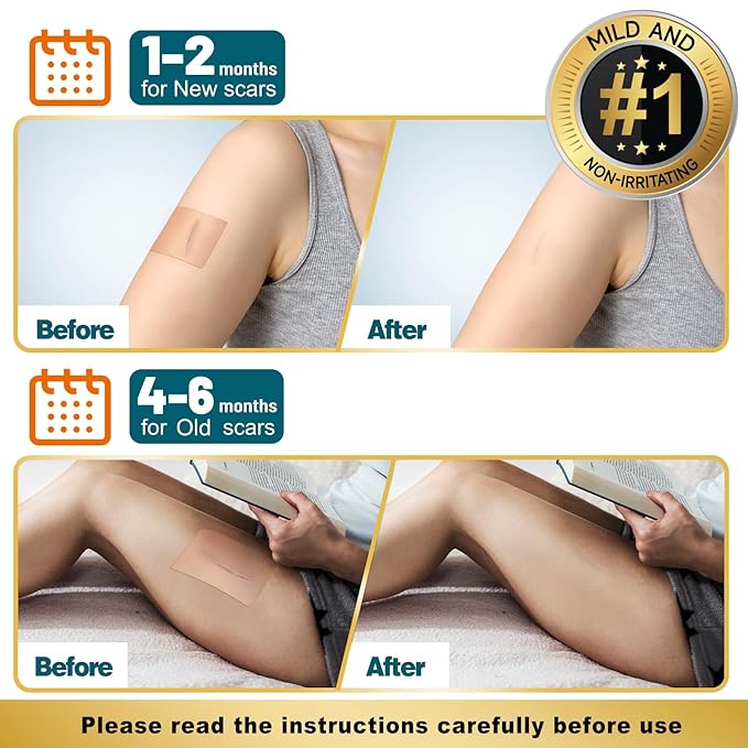 Arme Silicone Scar Tape, 18 Pack Silicone Scar Sheets, Medical Grade Scar Tape Removal Sheets for Surgical Scars, Reusable Scar Removal Strips for Tummy Tuck C-Section Keloid